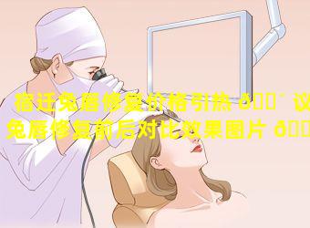 宿迁兔唇修复价格引热 🐴 议(兔唇修复前后对比效果图片 🐧 及恢复过)